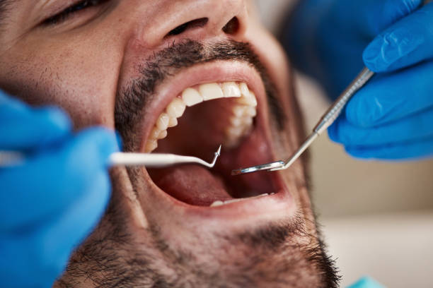 Best Pediatric Emergency Dentist in Crest View Heights, NY