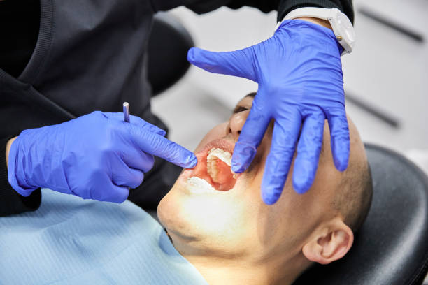 Best Emergency Dentist for Knocked-Out Tooth in Crest View Heights, NY